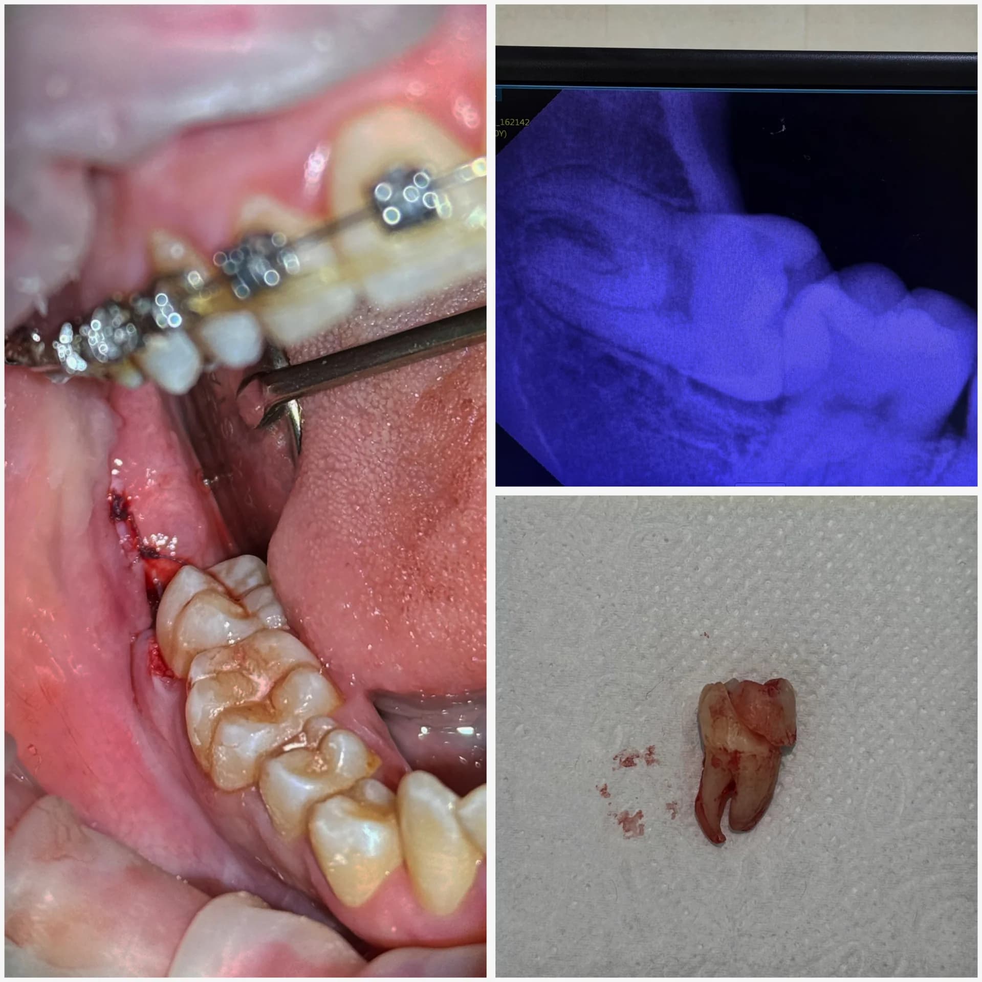 Master Dent