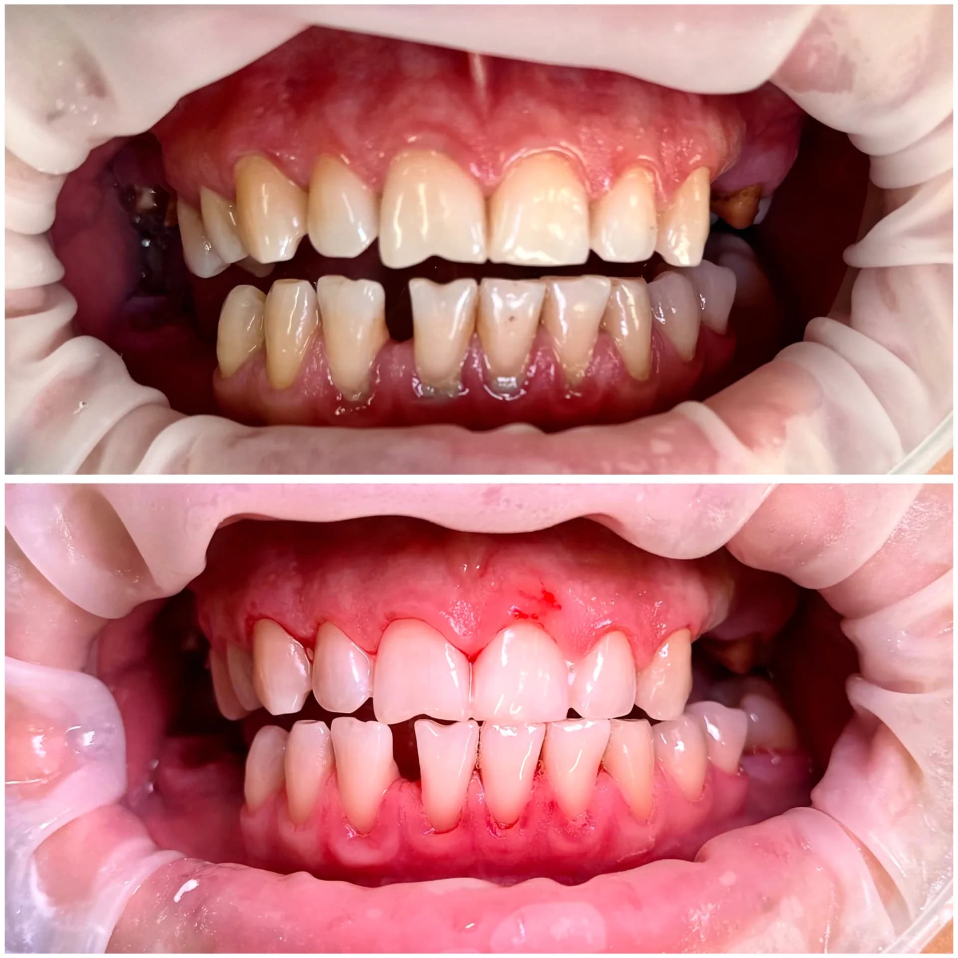 Master Dent