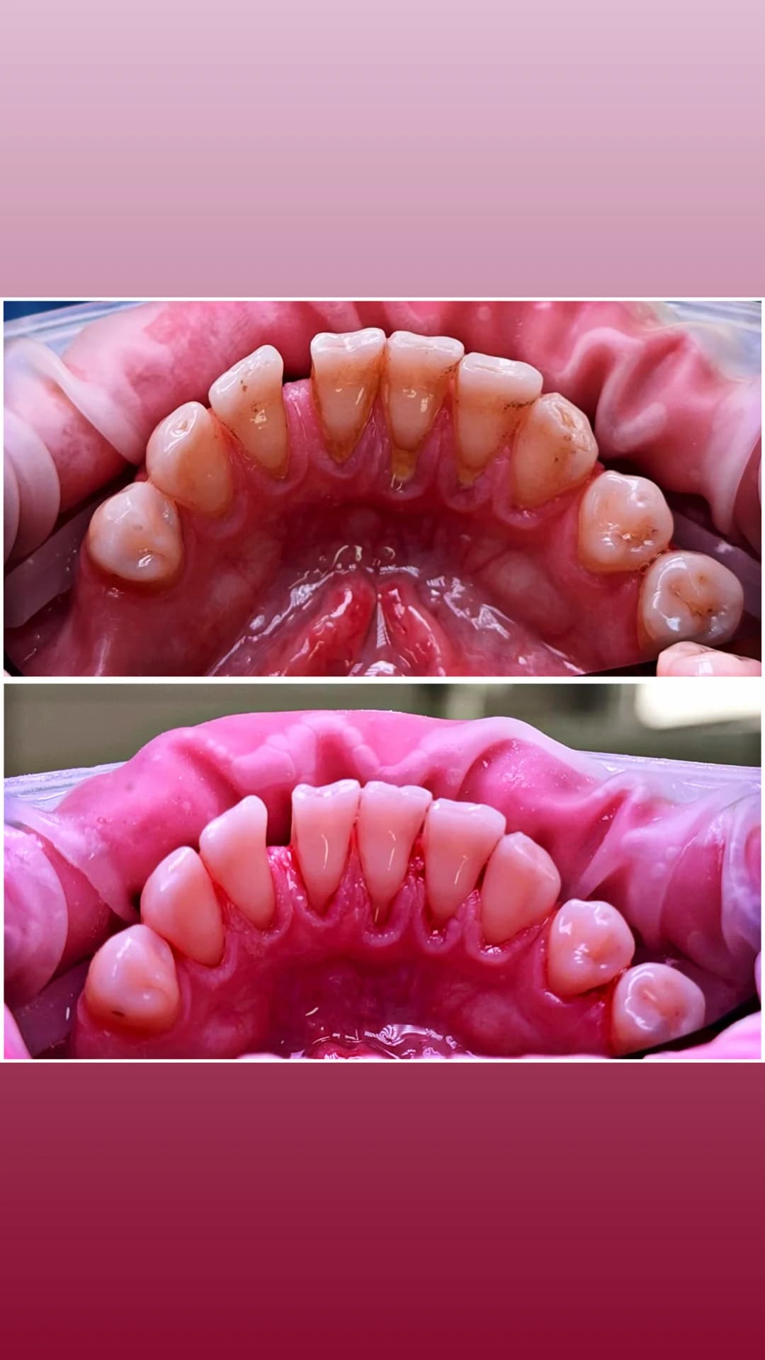 Master Dent