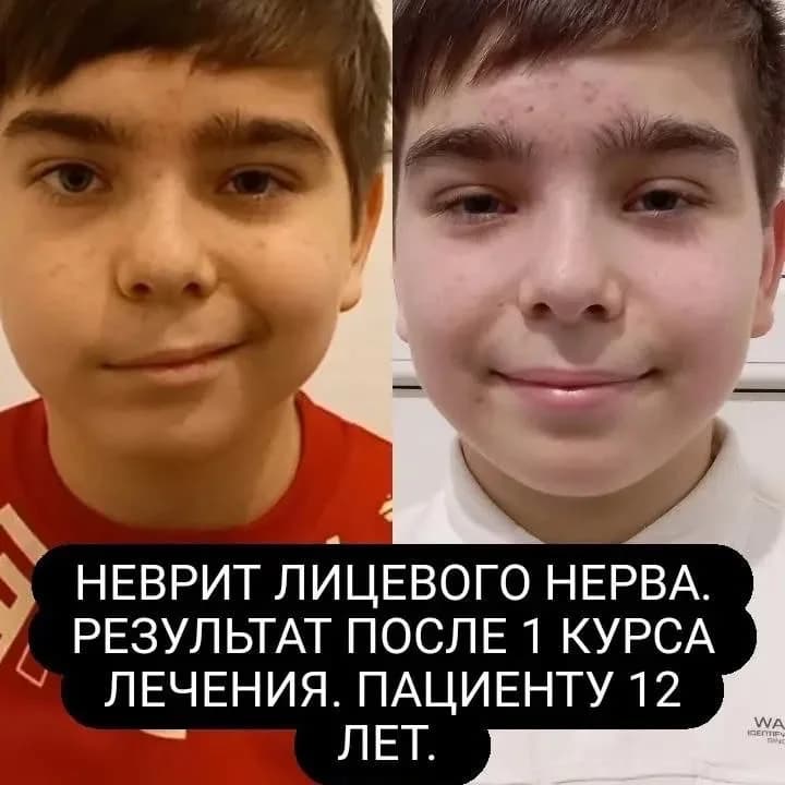 Апитерапия