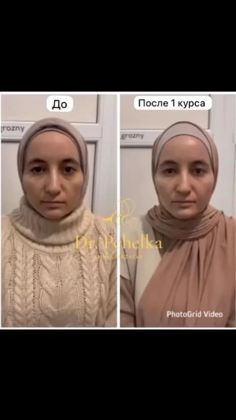 Апитерапия